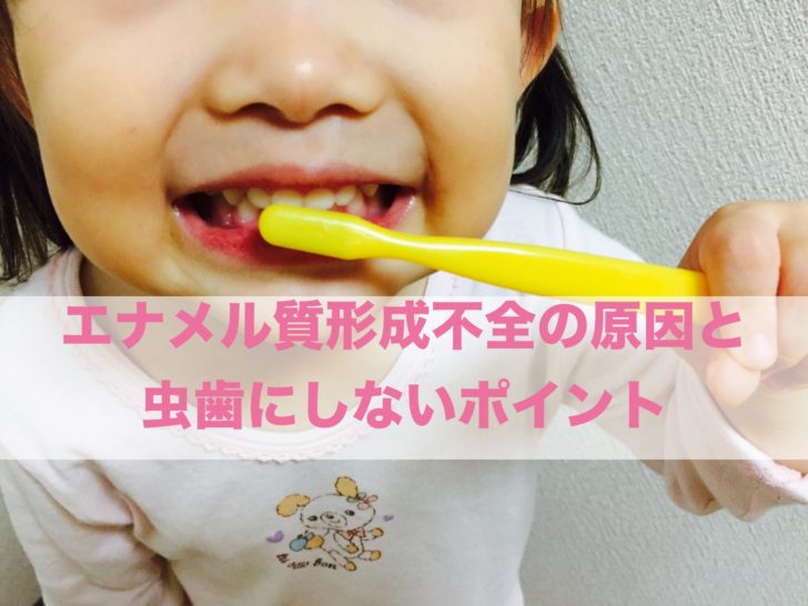 子供の歯の一部が黄色い 白い それってエナメル質形成不全かも 気をつける4つのポイント 年子ママのゆるいき